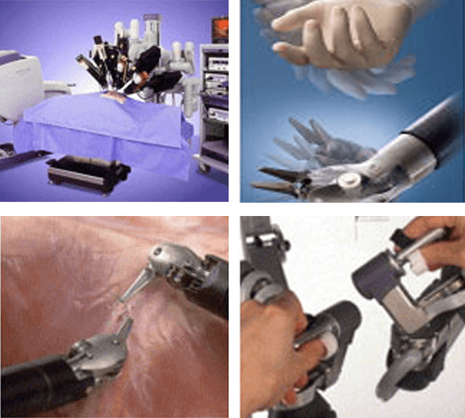 Robotic Surgery